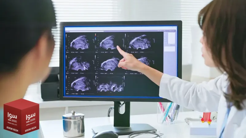 خبراء يدعون لإعادة تصنيف بطانة الرحم المهاجرة